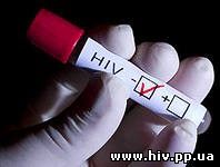 Более 150 тыс. ВИЧ-положительных свердловчан не знают о своем диагнозе