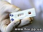 На Ямале пройдет единый день тестирования на ВИЧ-инфекцию