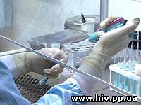 До 100 новых случаев заболевания ВИЧ регистрируют в Архангельске ежегодно