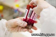 В РФ число заболевших ВИЧ ежегодно увеличивается на 10% 